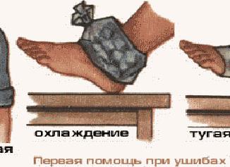 Первая помощь при переломах, растяжениях