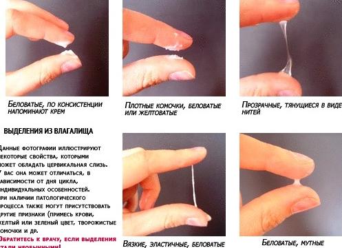 Что такое выделения?