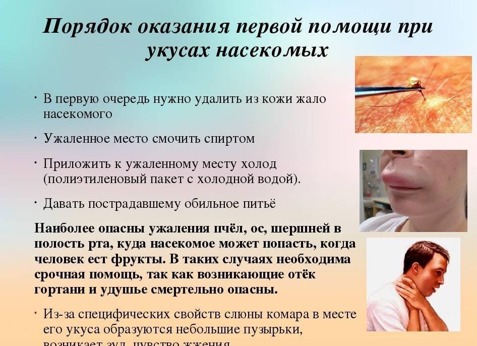 Первая помощь при укусах насекомых