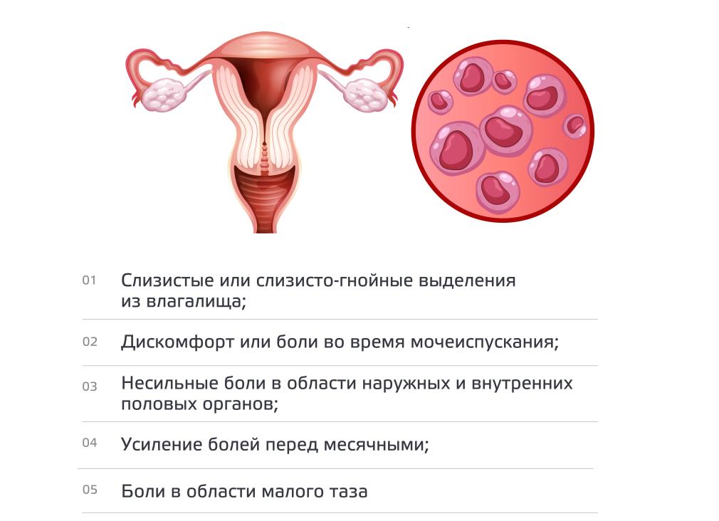 Симптомы хламидиоза