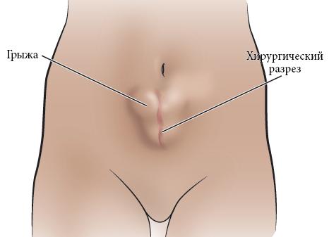 Рассказываю что произойдет с телом если перестать пить кофе на месяц