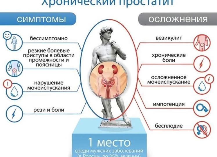 Методы лечения простатита